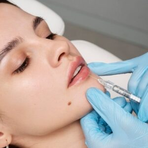 dermal fillers